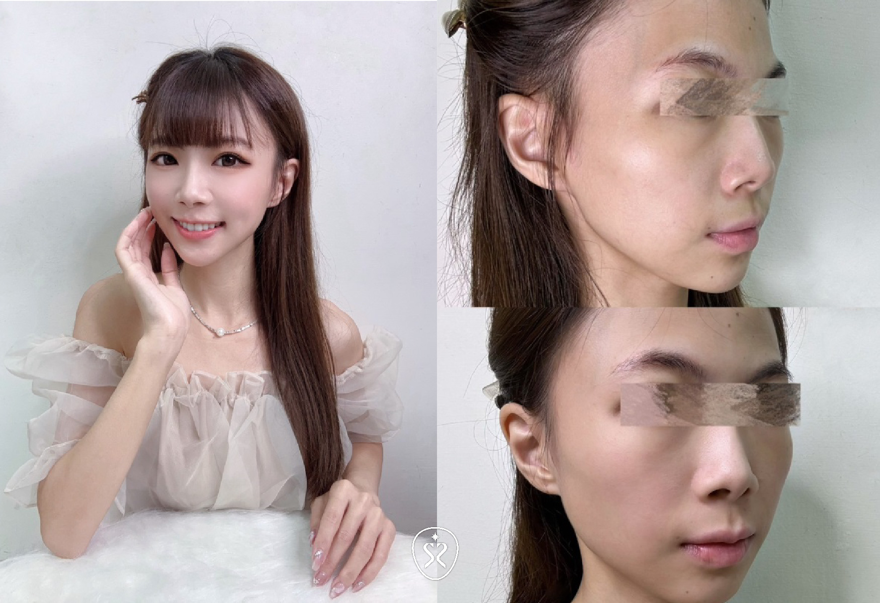 【喬雅登玻尿酸】